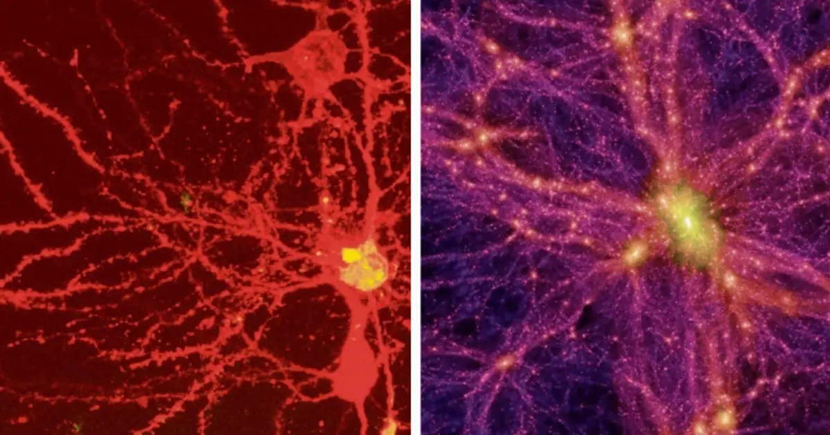 Can You Guess Which Is Our Universe And Which Is Our Brain? - News